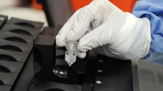 Ein Soldat setzt in München im Trainingsbereich im Mikrobiologischen Institut der Bundeswehr eine Probe in ein PCR-Gerät zur
