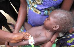 Hunger im Kongo