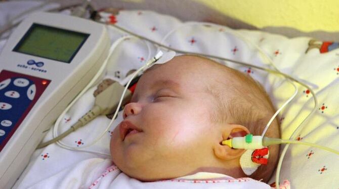 Hörscreening bei einem Neugeborenen: Ab sofort gelten neue Regeln für die Früherkennungsuntersuchungen bei Kindern. Foto: Fri