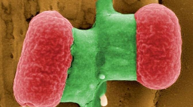 Der EHEC-Erreger verbreitet weiter Angst und Schrecken.