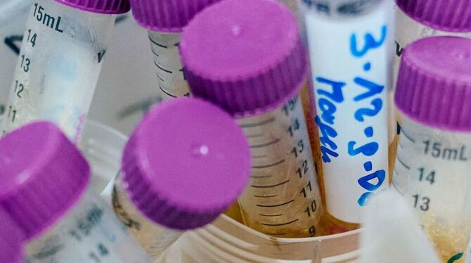Tiefgefrorene Urinproben liegen in einem Labor